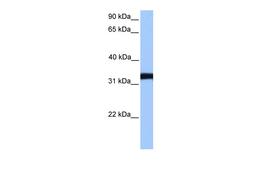 Antibody used in WB on Human NTERA2 at 0.2-1 ug/ml.