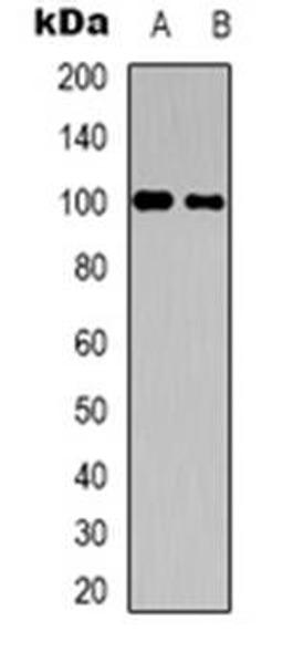 Western blot analysis of CNTROB expression in HepG2 (Lane 1), HUVEC (Lane 2) whole cell lysates using CNTROB antibody