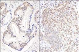 Detection of human and mouse EFTUD2/SNRP116 by immunohistochemistry.