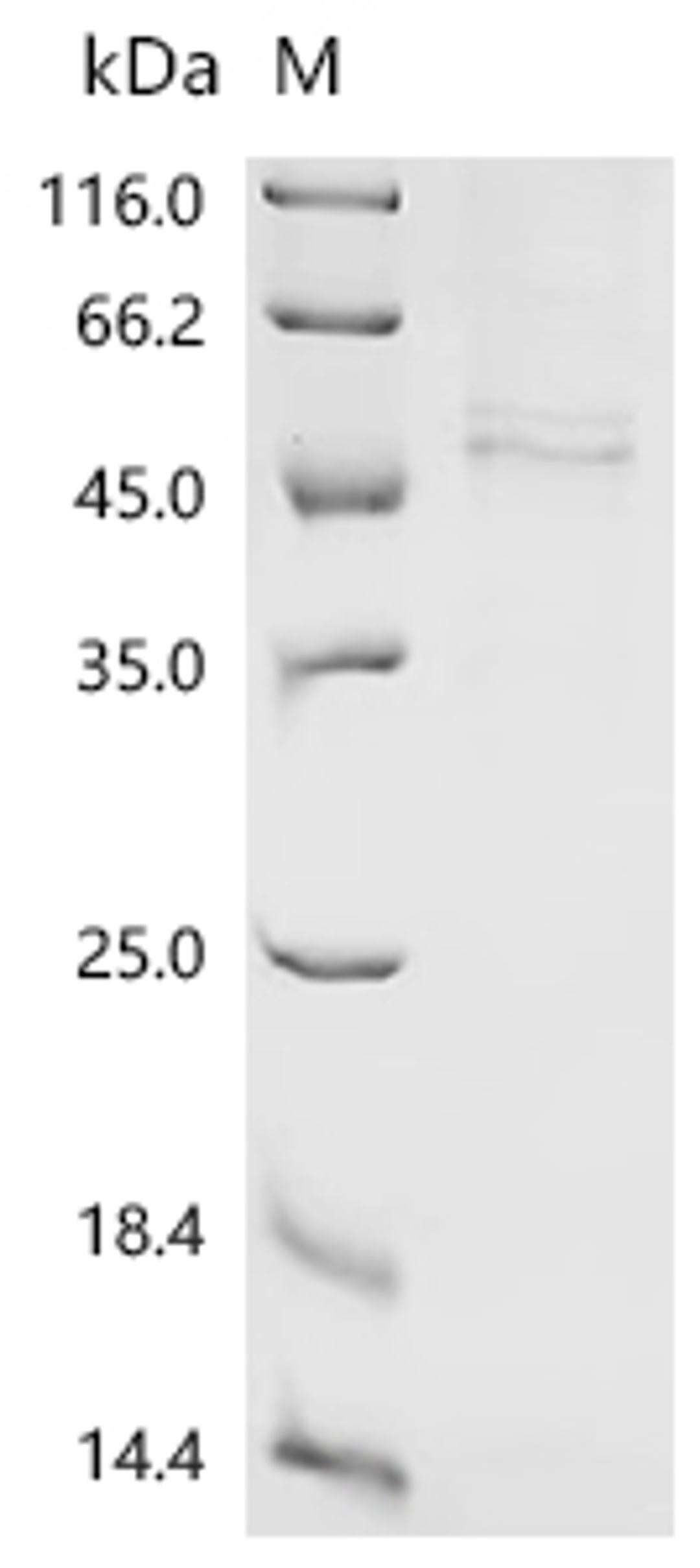 (Tris-Glycine gel) Discontinuous SDS-PAGE (reduced) with 5% enrichment gel and 15% separation gel.