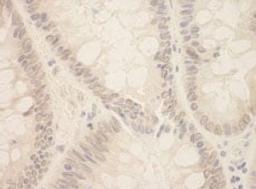 Detection of human SIP1 by immunohistochemistry.