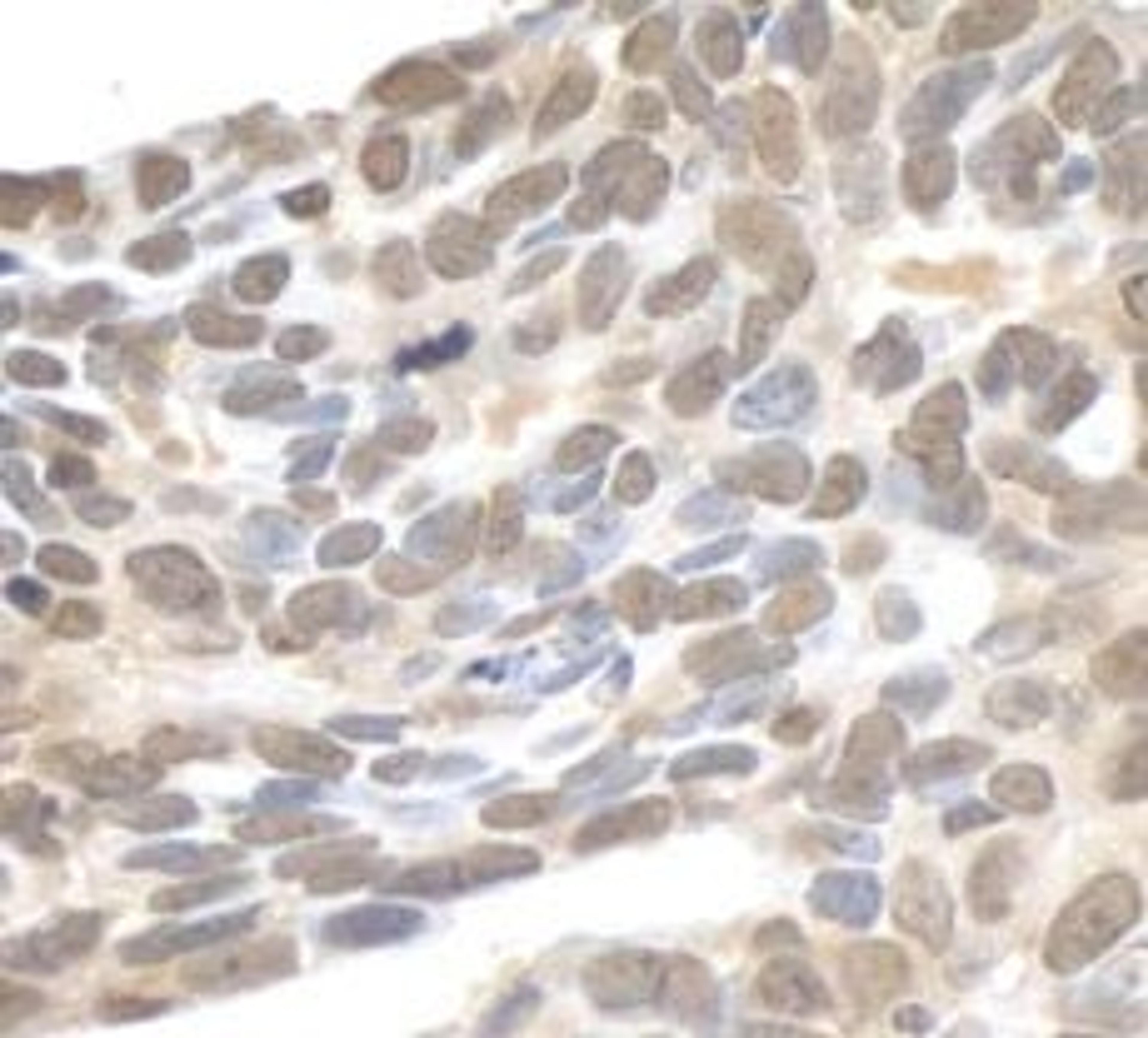 Detection of human XPA by immunohistochemistry.