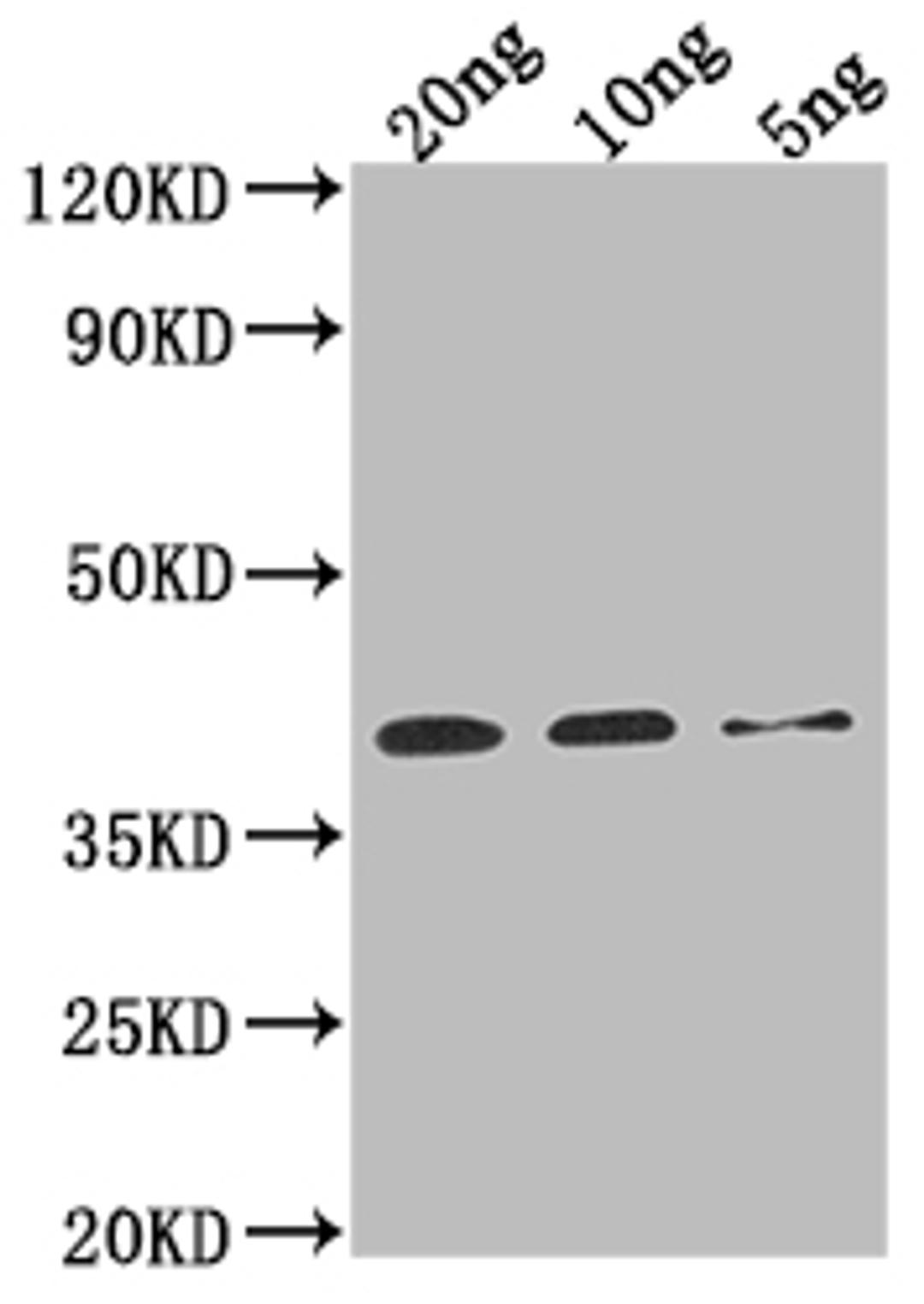Western Blot. Positive WB detected in Recombinant protein. All lanes: Sarcoplasmic calcium binding protein antibody at 1:2000. Secondary. Goat polyclonal to rabbit IgG at 1/50000 dilution. Predicted band size: 38.1 kDa. Observed band size: 38 kDa. 