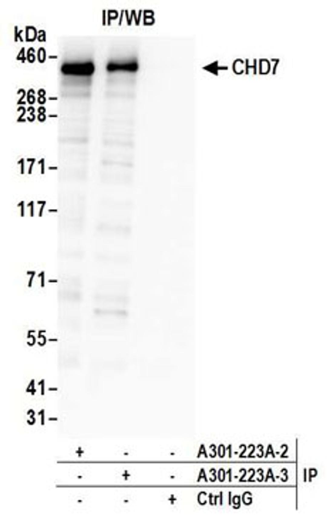 Detection of human CHD7 by western blot of immunoprecipitates.