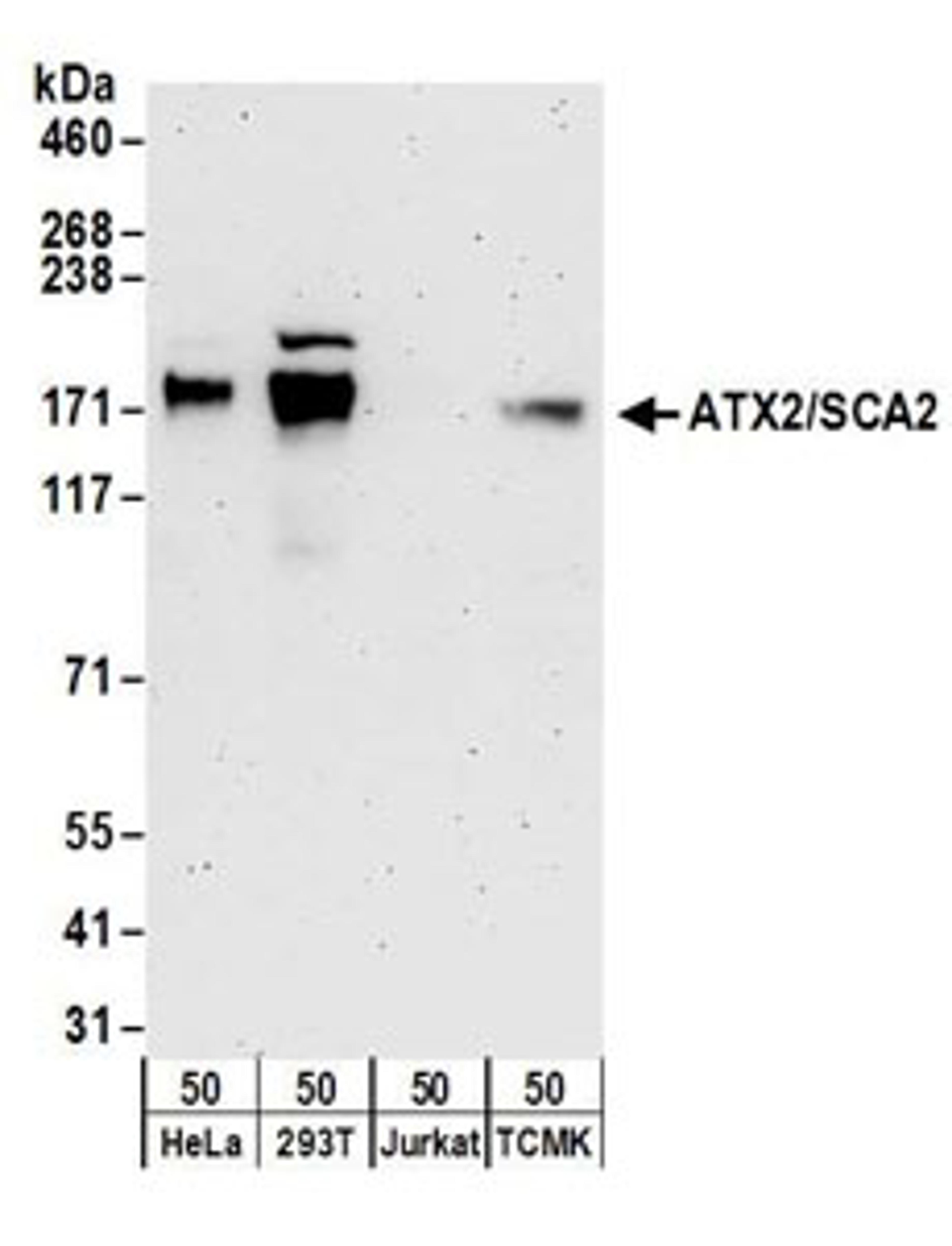 Detection of human and mouse ATX2/SCA2 by western blot.