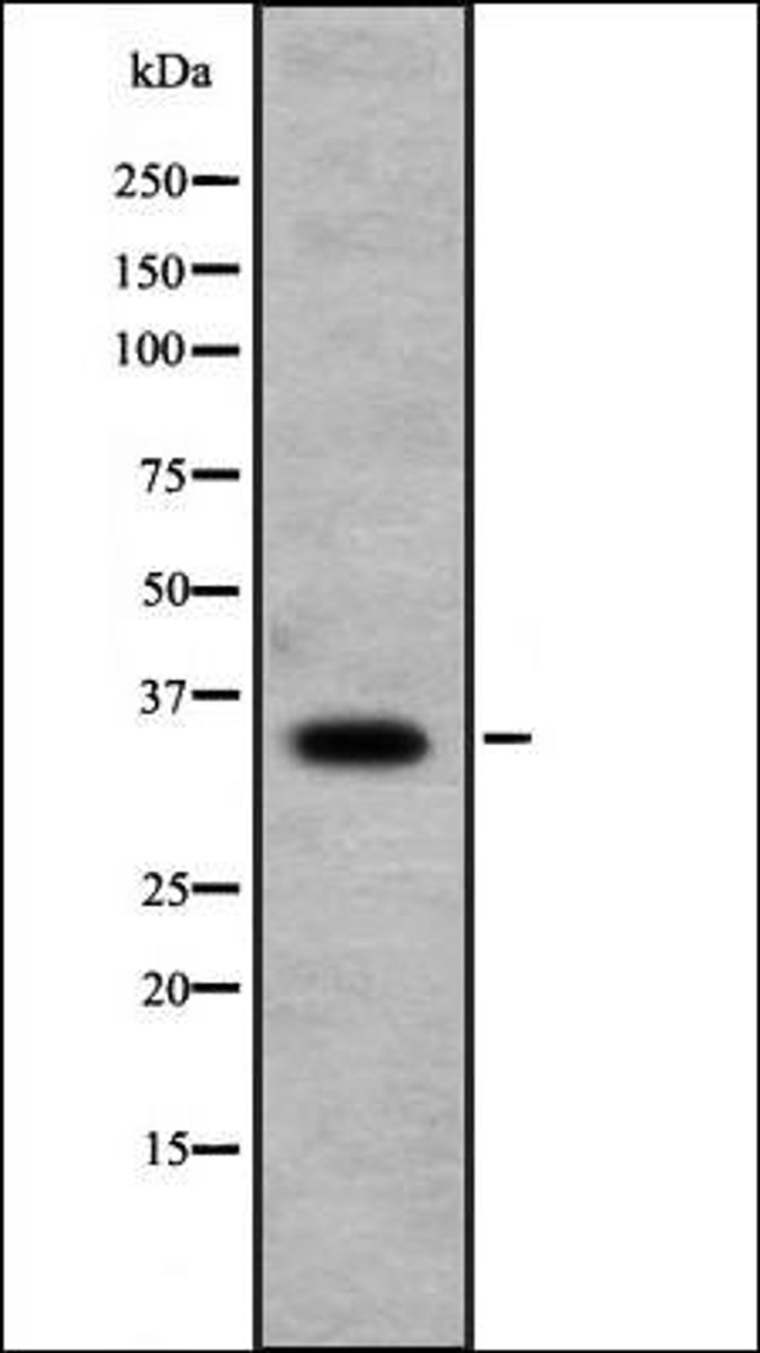 Western blot analysis of Jurkat cell lysate using RFPL1 antibody