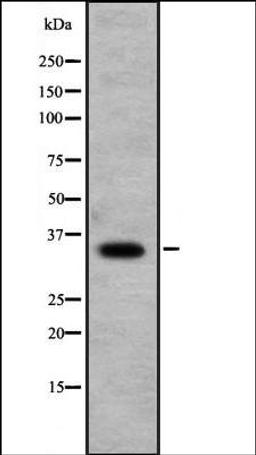 Western blot analysis of Jurkat cell lysate using RFPL1 antibody