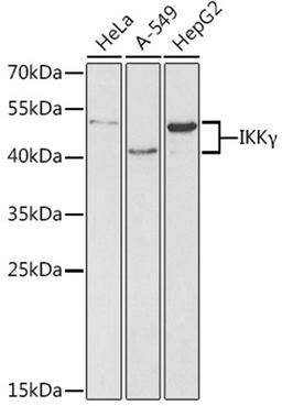 Western blot - IKK? antibody (A0917)