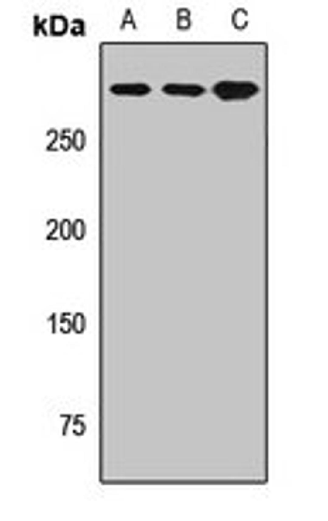 Western blot analysis of Hela (Lane1), mouse lung (Lane2), rat lung (Lane3) whole cell lysates using EVPL antibody