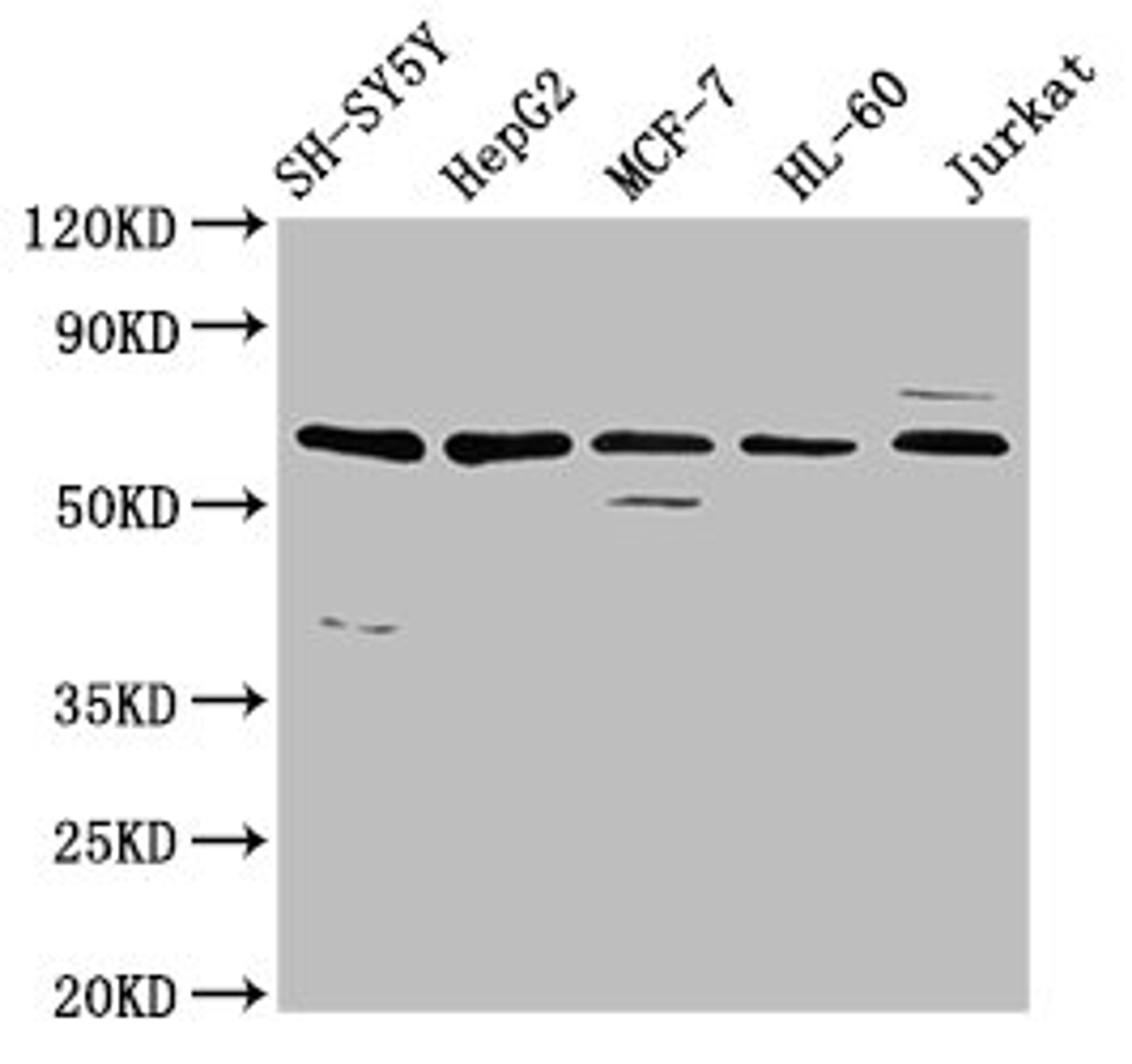 Western Blot. Positive WB detected in: SH-SY5Y whole cell lysate, HepG2 whole cell lysate, MCF-7 whole cell lysate, HL-60 whole cell lysate, Jurkat whole cell lysate. All lanes: HRG antibody at 4.6µg/ml. Secondary. Goat polyclonal to rabbit IgG at 1/50000 dilution. Predicted band size: 60 kDa. Observed band size: 60 kDa