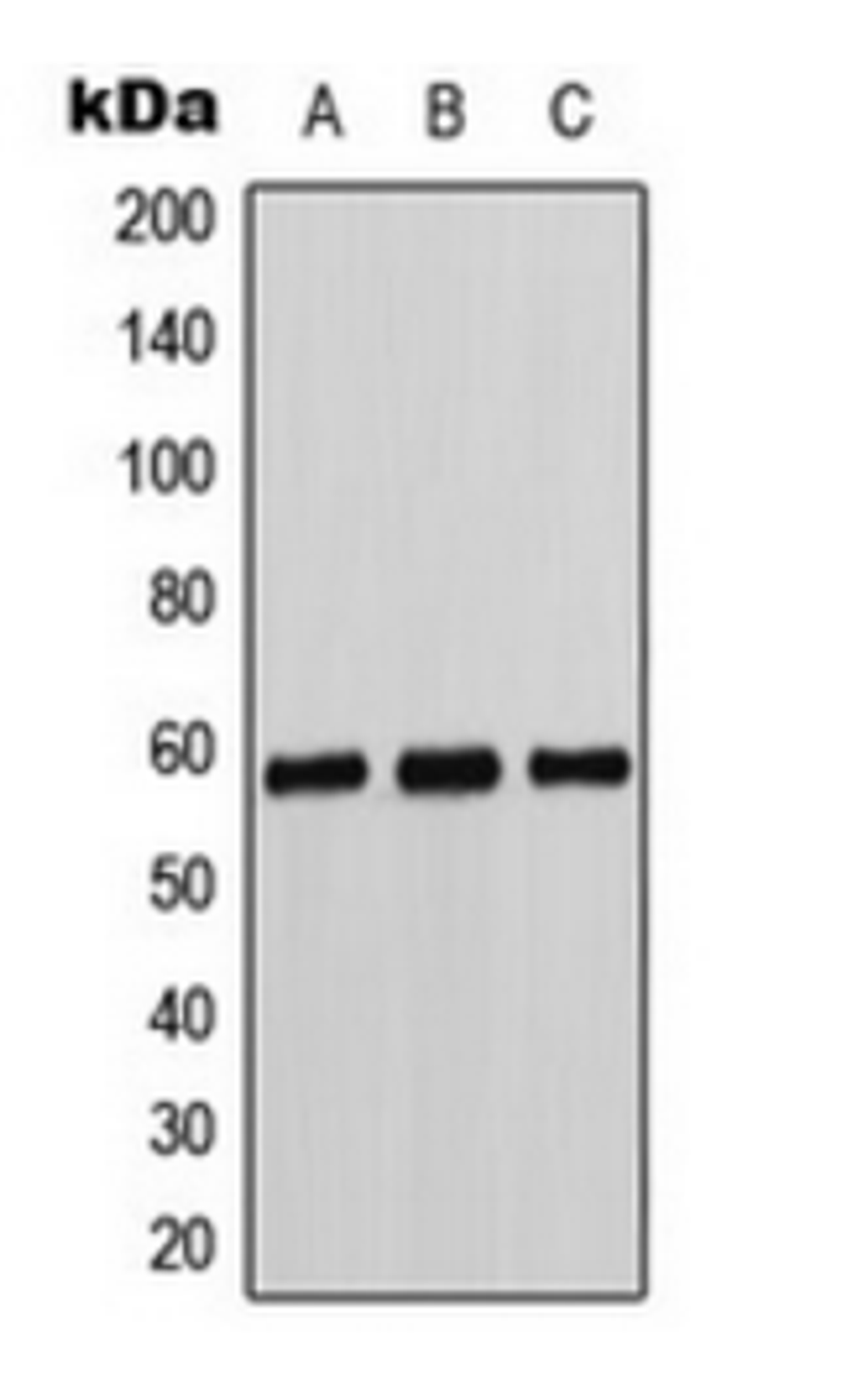 Western blot analysis of K562 (Lane 1), Caki1 (Lane 2), MCF7 (Lane 3) whole cell lysates using Cytochrome P450 11B1/2 antibody