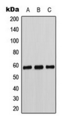 Western blot analysis of K562 (Lane 1), Caki1 (Lane 2), MCF7 (Lane 3) whole cell lysates using Cytochrome P450 11B1/2 antibody