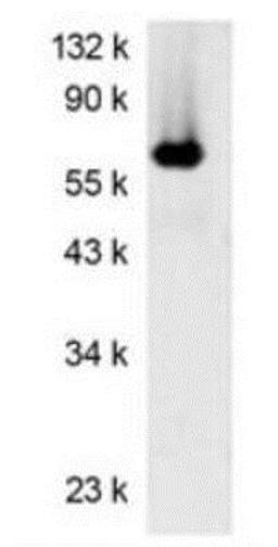 Western Blot: Luciferase (firefly) Antibody (Luci17) [NBP1-78997]