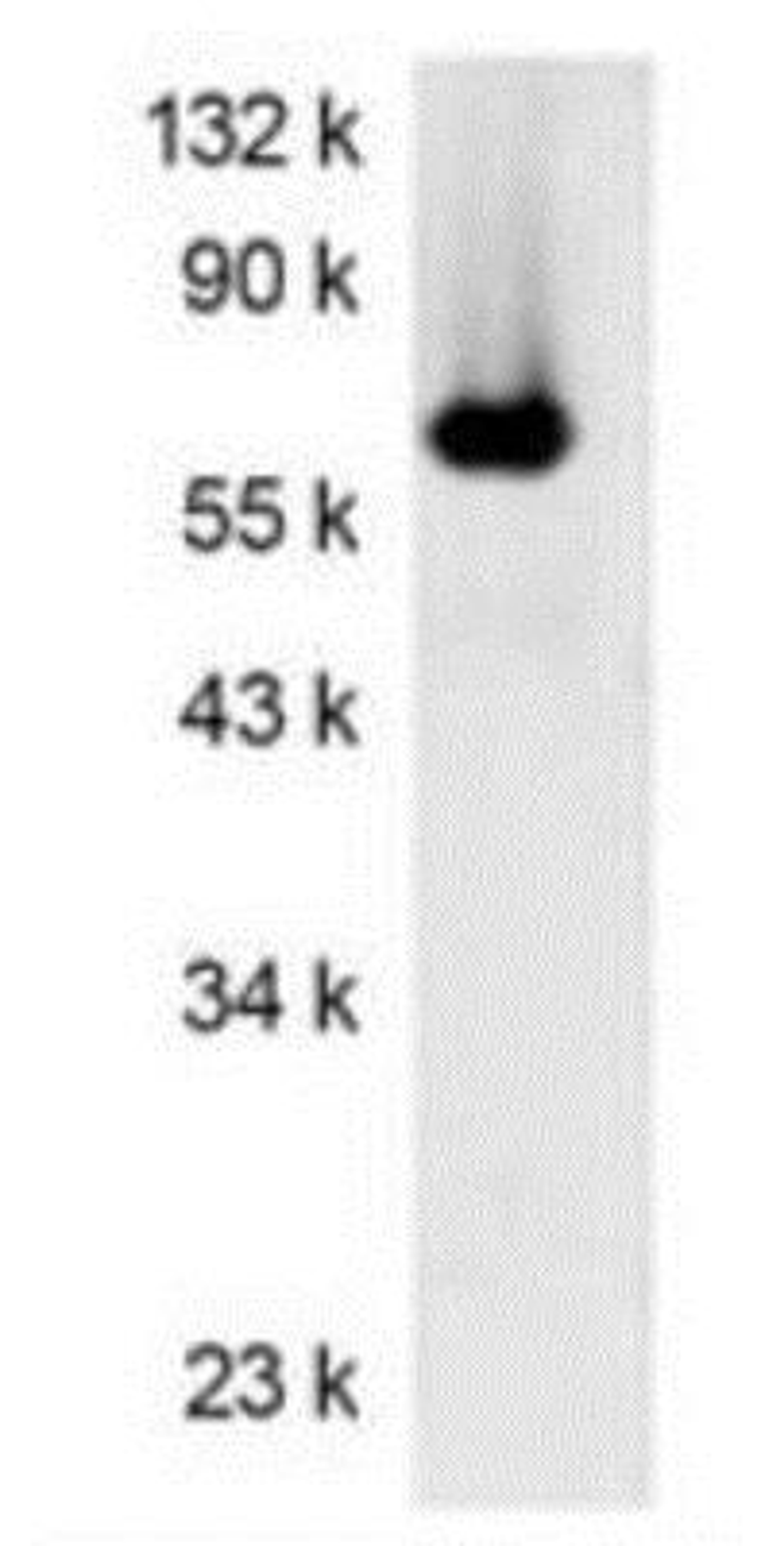 Western Blot: Luciferase (firefly) Antibody (Luci17) [NBP1-78997]