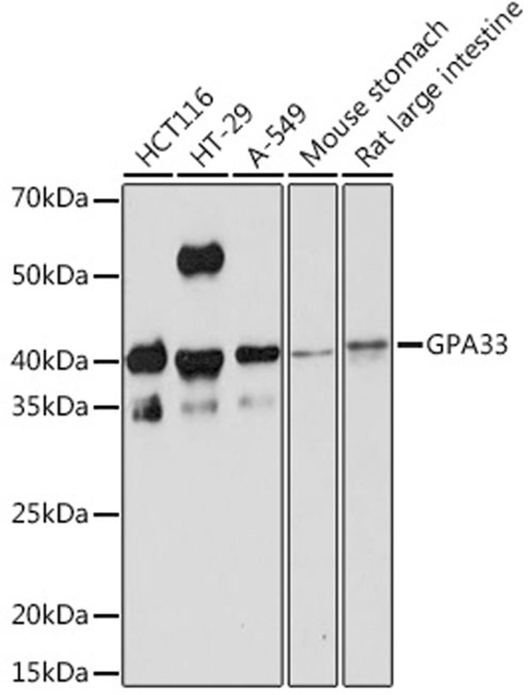 Western blot - GPA33 Rabbit mAb (A3608)