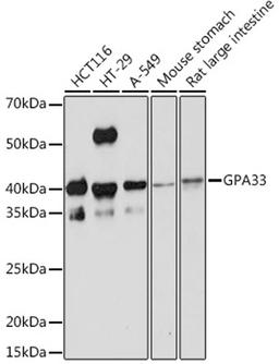 Western blot - GPA33 Rabbit mAb (A3608)