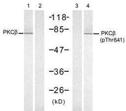 Western blot analysis of lysed extracts from K562 cells, untreated or treated with PMA (1 ng/mL, 10min), using PKC, (Lane 1 and 2) and PKC, (Lane 3 and 4).