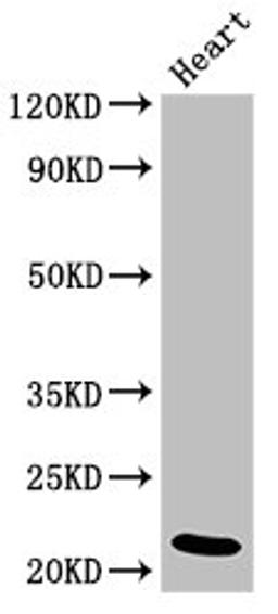 Western Blot. Positive WB detected in: Rat heart tissue. All lanes: NDUFB9 antibody at 4ug/ml. Secondary. Goat polyclonal to rabbit IgG at 1/50000 dilution. Predicted band size: 22 kDa. Observed band size: 22 kDa.