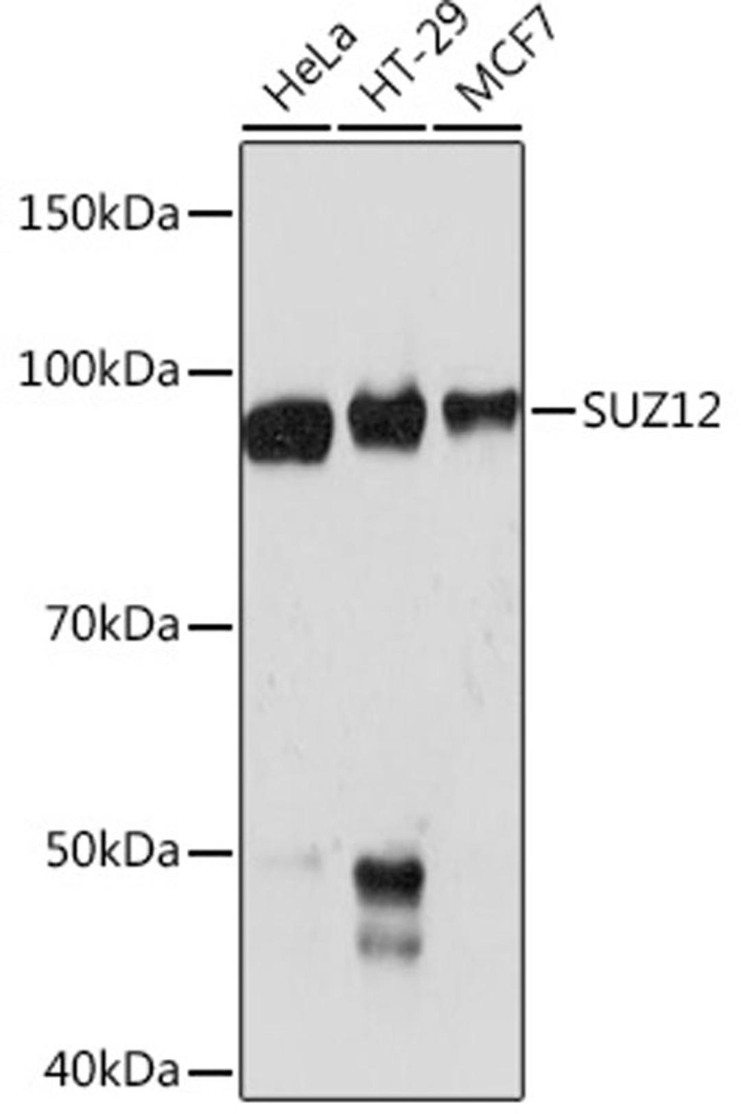 Western blot - SUZ12 Rabbit mAb (A4348)