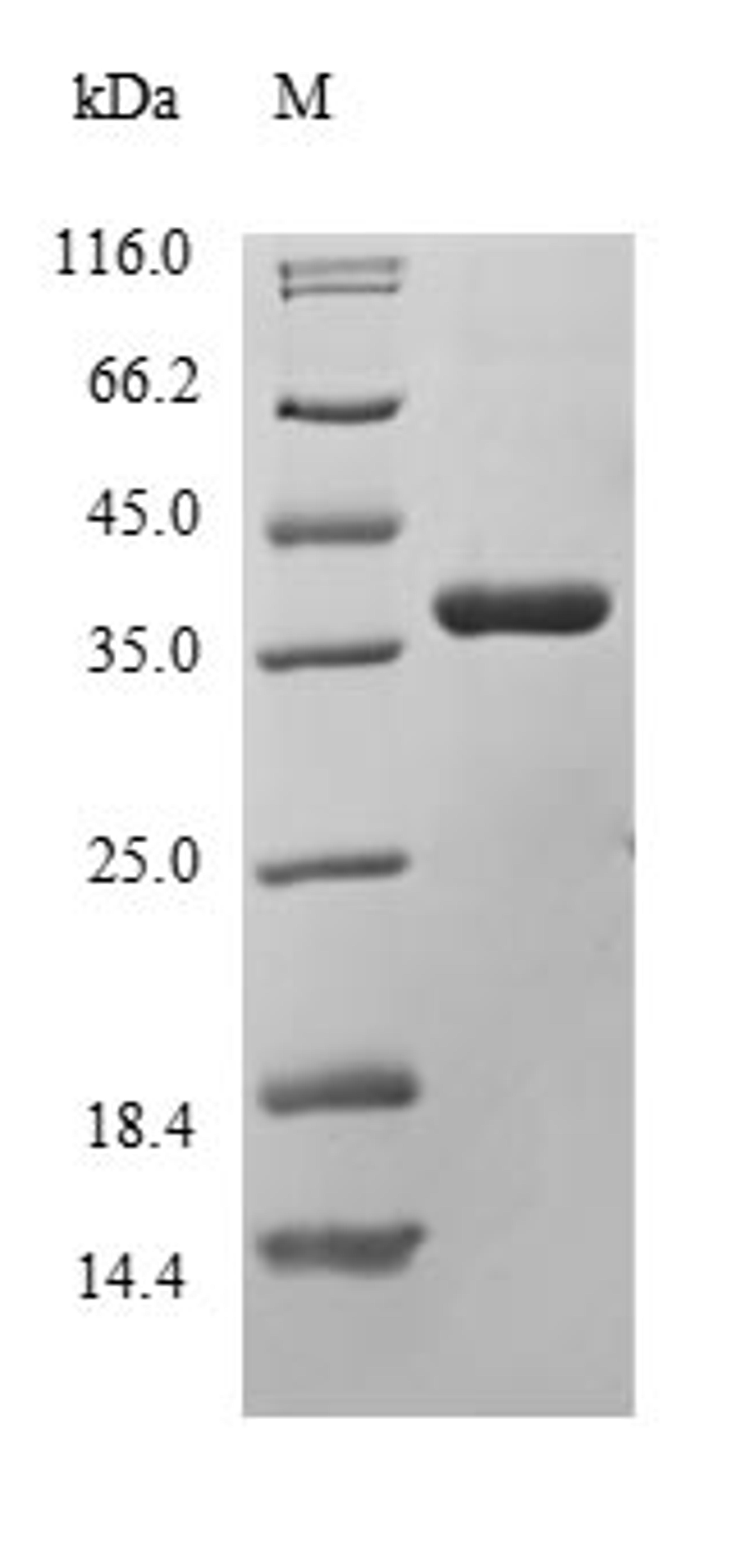 (Tris-Glycine gel) Discontinuous SDS-PAGE (reduced) with 5% enrichment gel and 15% separation gel.