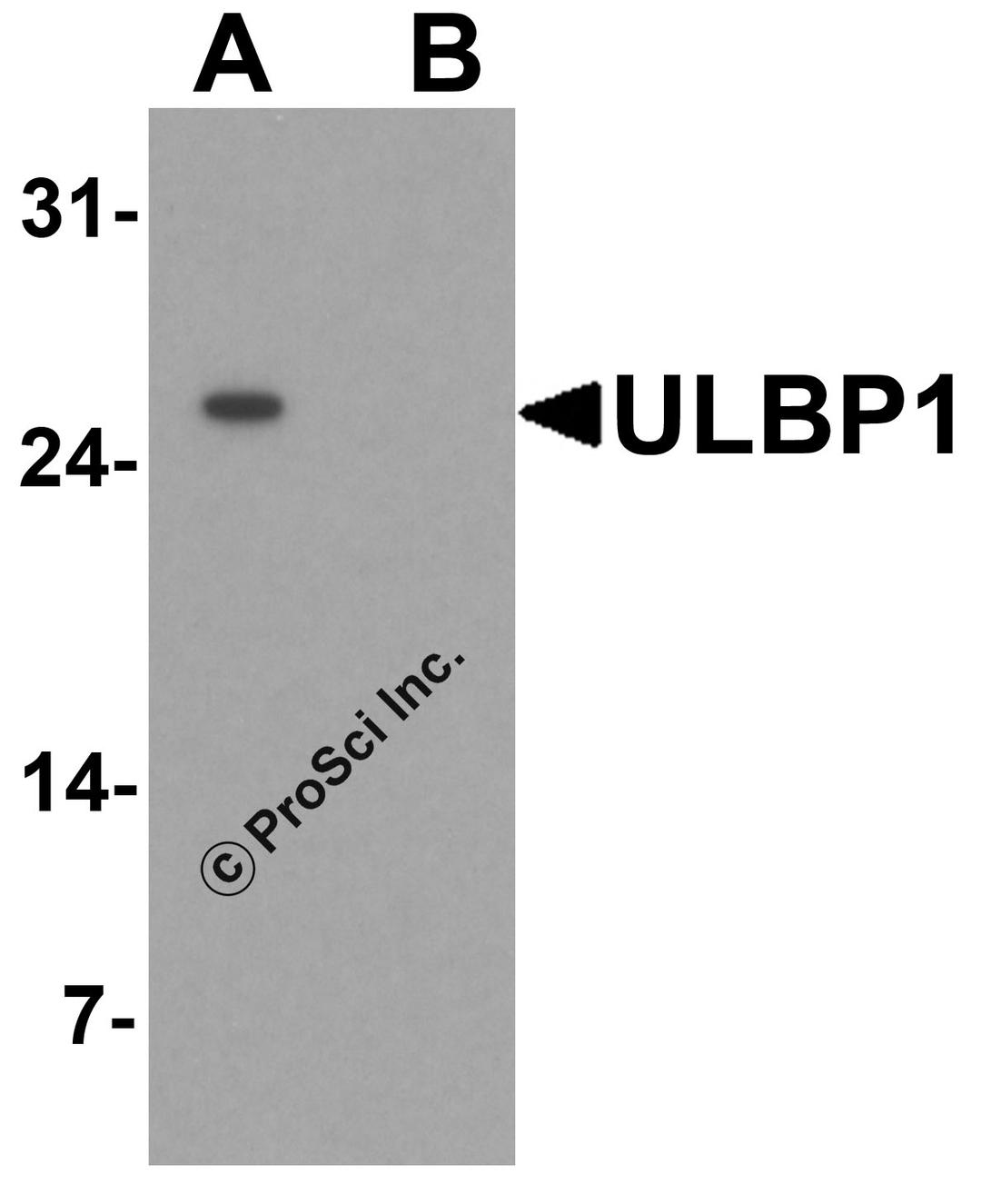 Western blot analysis of ULBP1 in RAW264.7 cell lysate with ULBP1 antibody at 1 μg/mL in (A) the absence and (B) the presence of blocking peptide.