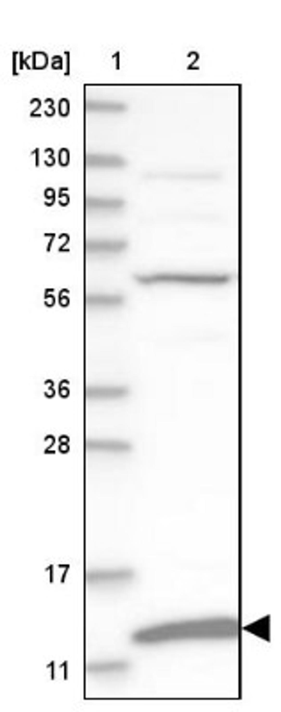 Western Blot: MRPS36 Antibody [NBP1-85286] - Lane 1: Marker [kDa] 230, 130, 95, 72, 56, 36, 28, 17, 11<br/>Lane 2: Human cell line RT-4