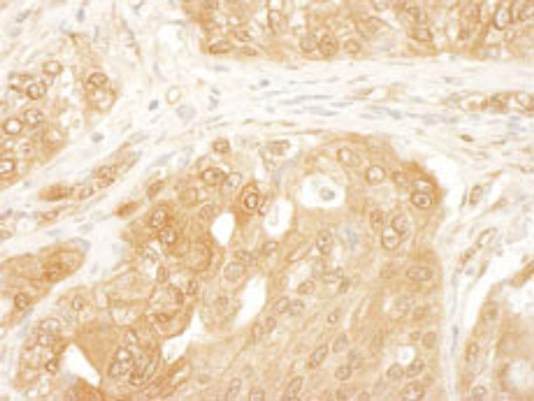 Detection of human YAP1 by immunohistochemistry.