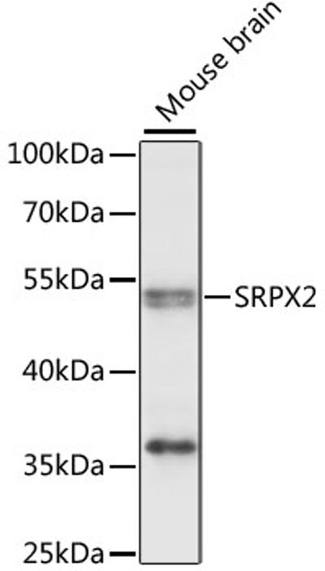 Western blot - SRPX2 antibody (A15434)