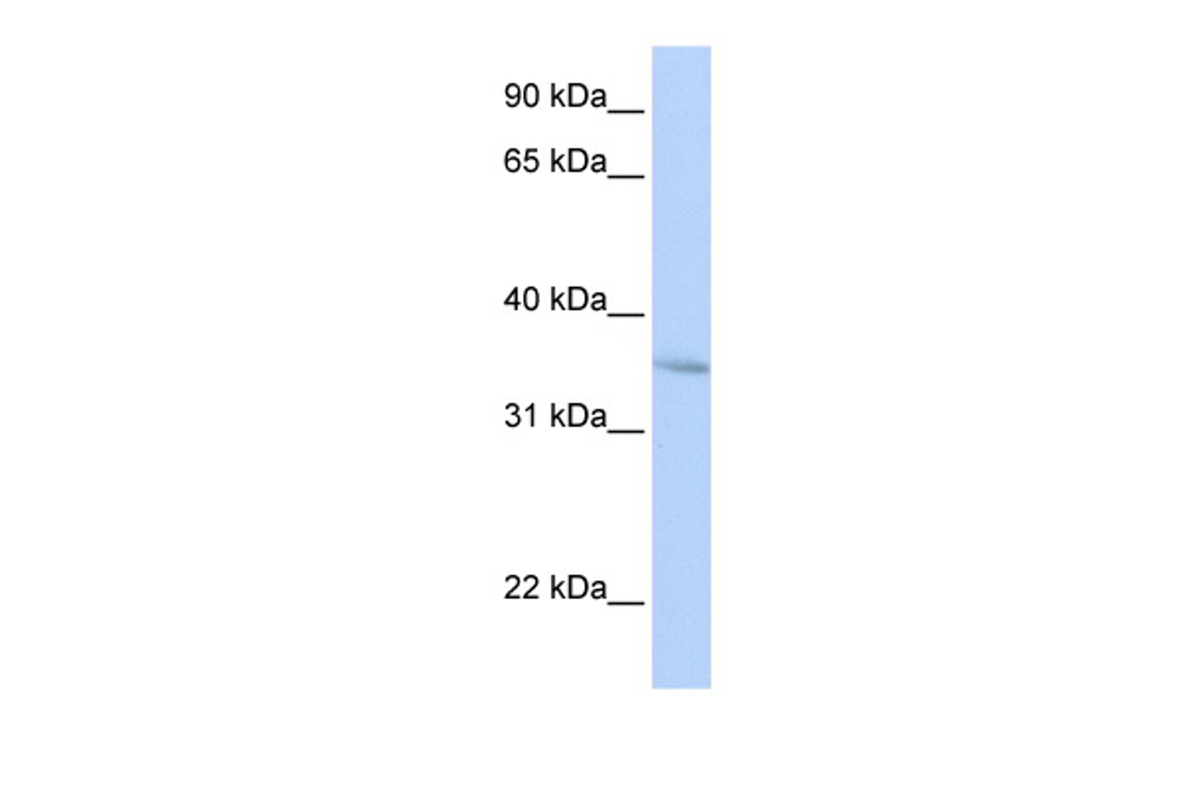 Antibody used in WB on Human HepG2 at 0.2-1 ug/ml.