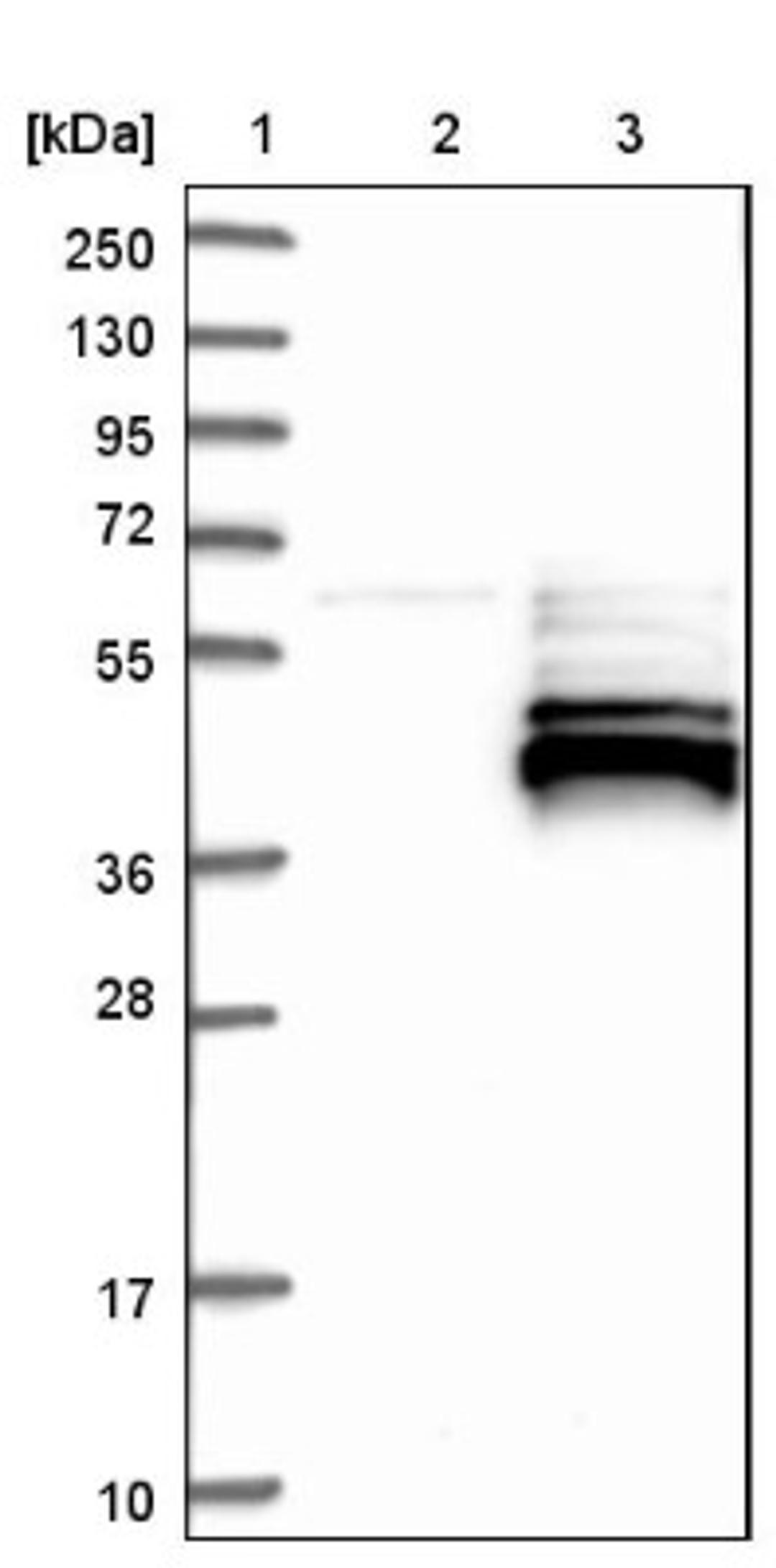 Western Blot: ZNF364 Antibody [NBP1-85586] - Lane 1: Marker [kDa] 250, 130, 95, 72, 55, 36, 28, 17, 10<br/>Lane 2: Negative control (vector only transfected HEK293T lysate)<br/>Lane 3: Over-expression lysate (Co-expressed with a C-terminal myc-DDK tag (~3.1 kDa) in mammalian HEK293T cells, LY415260)