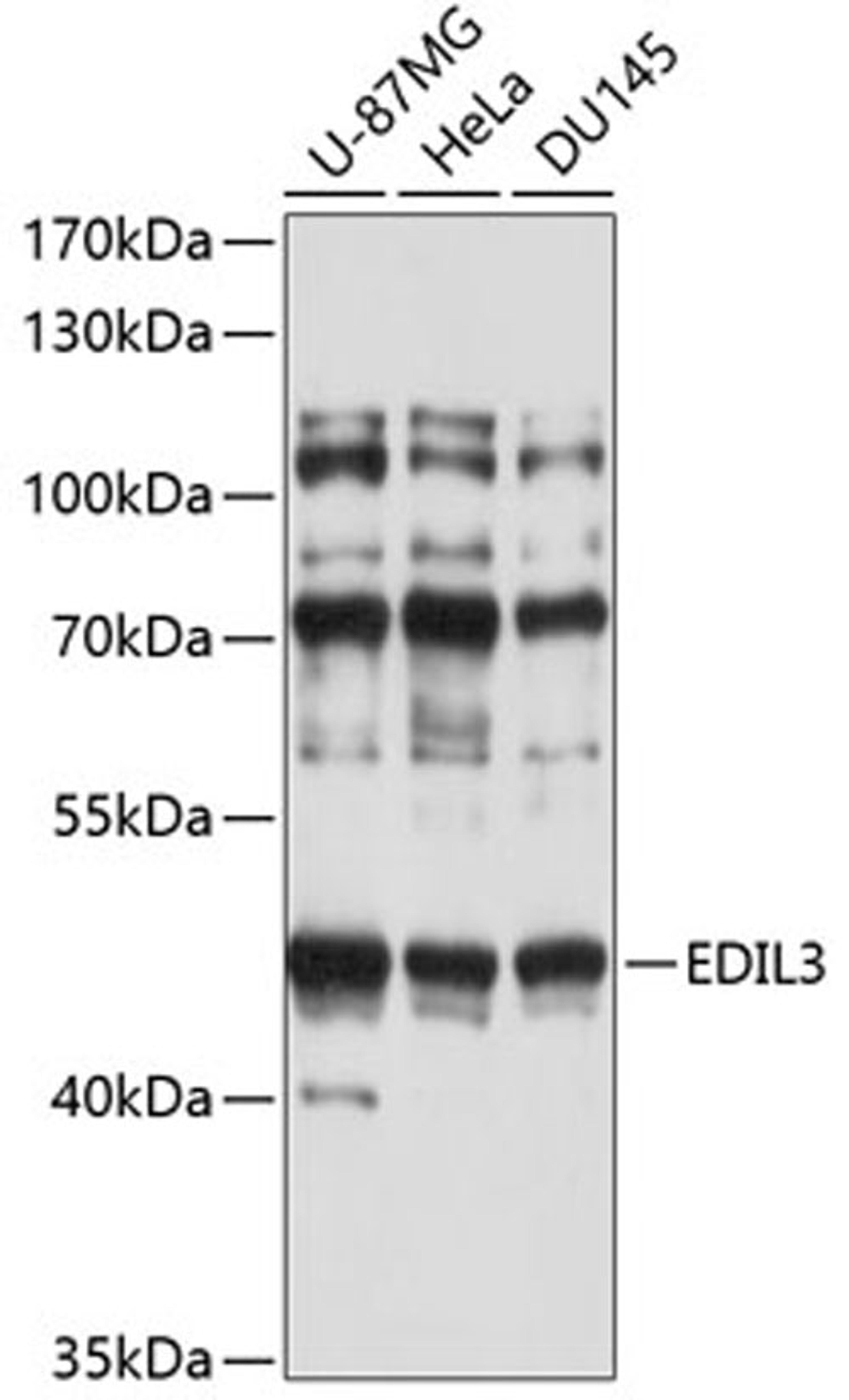 Western blot - EDIL3 antibody (A4370)