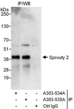 Detection of human Sprouty 2 by western blot of immunoprecipitates.