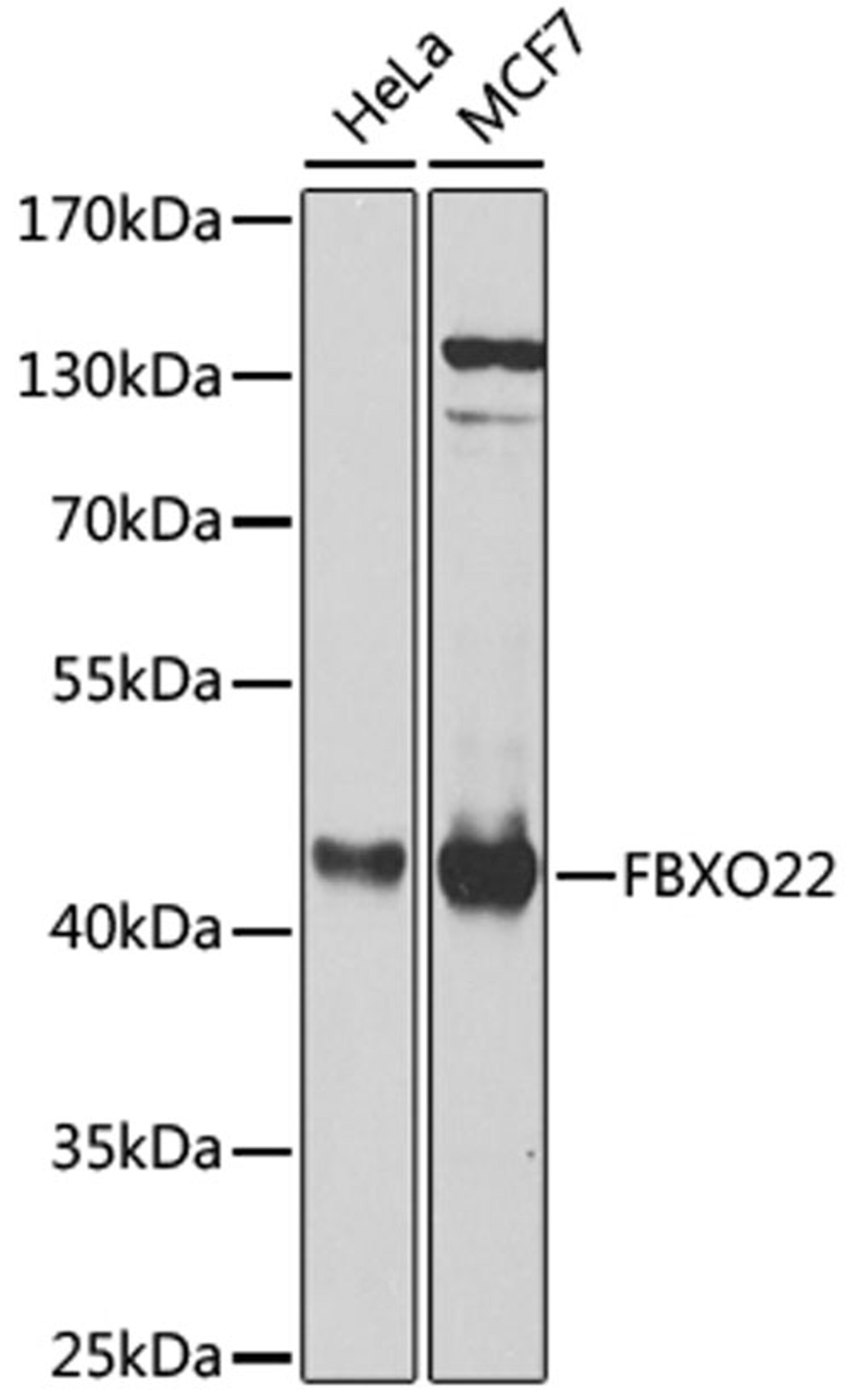 Western blot - FBXO22 antibody (A8367)