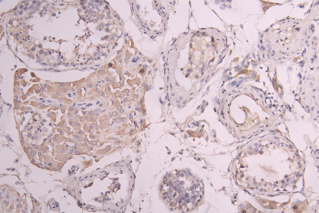 IHC image of CSB-RA860321MA1HU diluted at 1:100 and staining in paraffin-embedded human testis tissue performed on a Leica BondTM system. After dewaxing and hydration, antigen retrieval was mediated by high pressure in a citrate buffer (pH 6.0). Section was blocked with 10% normal goat serum 30min at RT. Then primary antibody (1% BSA) was incubated at 4°C overnight. The primary is detected by a Goat anti-human polymer IgG labeled by HRP and visualized using 0.05% DAB.