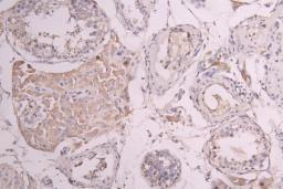 IHC image of CSB-RA860321MA1HU diluted at 1:100 and staining in paraffin-embedded human testis tissue performed on a Leica BondTM system. After dewaxing and hydration, antigen retrieval was mediated by high pressure in a citrate buffer (pH 6.0). Section was blocked with 10% normal goat serum 30min at RT. Then primary antibody (1% BSA) was incubated at 4°C overnight. The primary is detected by a Goat anti-human polymer IgG labeled by HRP and visualized using 0.05% DAB.