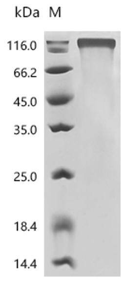 (Tris-Glycine gel) Discontinuous SDS-PAGE (reduced) with 5% enrichment gel and 15% separation gel.