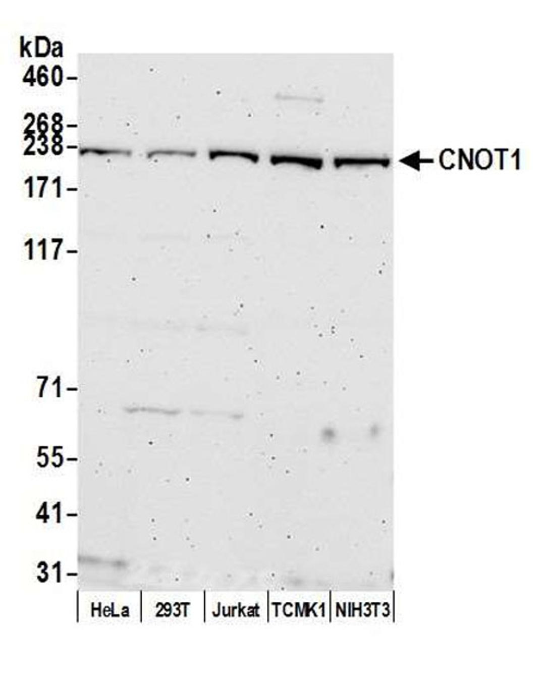 Detection of human and mouse CNOT1 by WB.