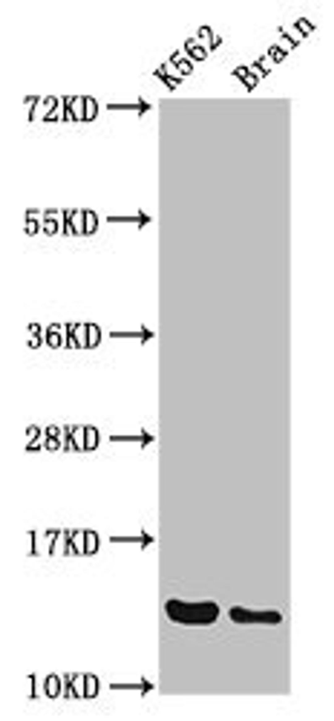 Western Blot. Positive WB detected in: K562 whole cell lysate, Rat brain tissue. All lanes: BET1 antibody at 3.4µg/ml. Secondary. Goat polyclonal to rabbit IgG at 1/50000 dilution. Predicted band size: 14, 10 kDa. Observed band size: 14 kDa