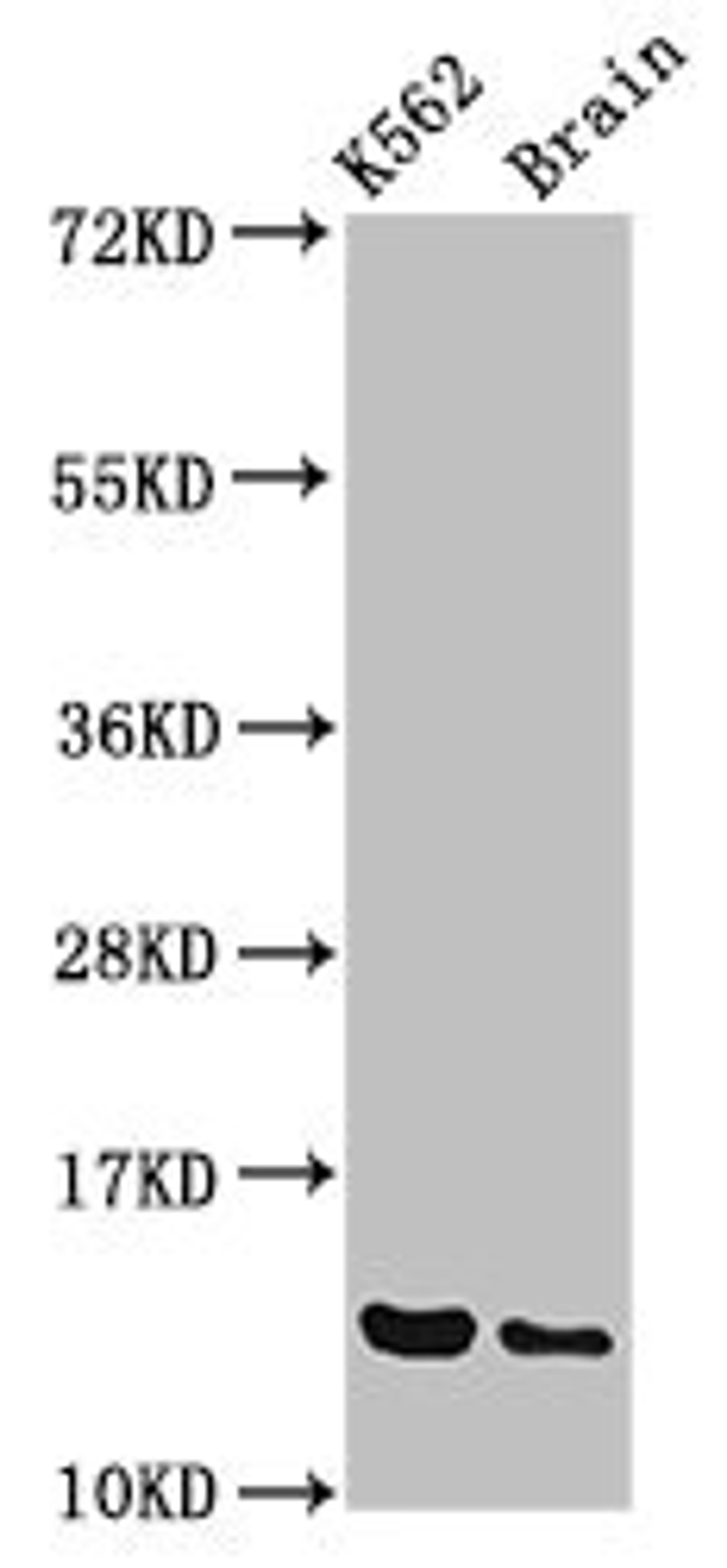 Western Blot. Positive WB detected in: K562 whole cell lysate, Rat brain tissue. All lanes: BET1 antibody at 3.4µg/ml. Secondary. Goat polyclonal to rabbit IgG at 1/50000 dilution. Predicted band size: 14, 10 kDa. Observed band size: 14 kDa