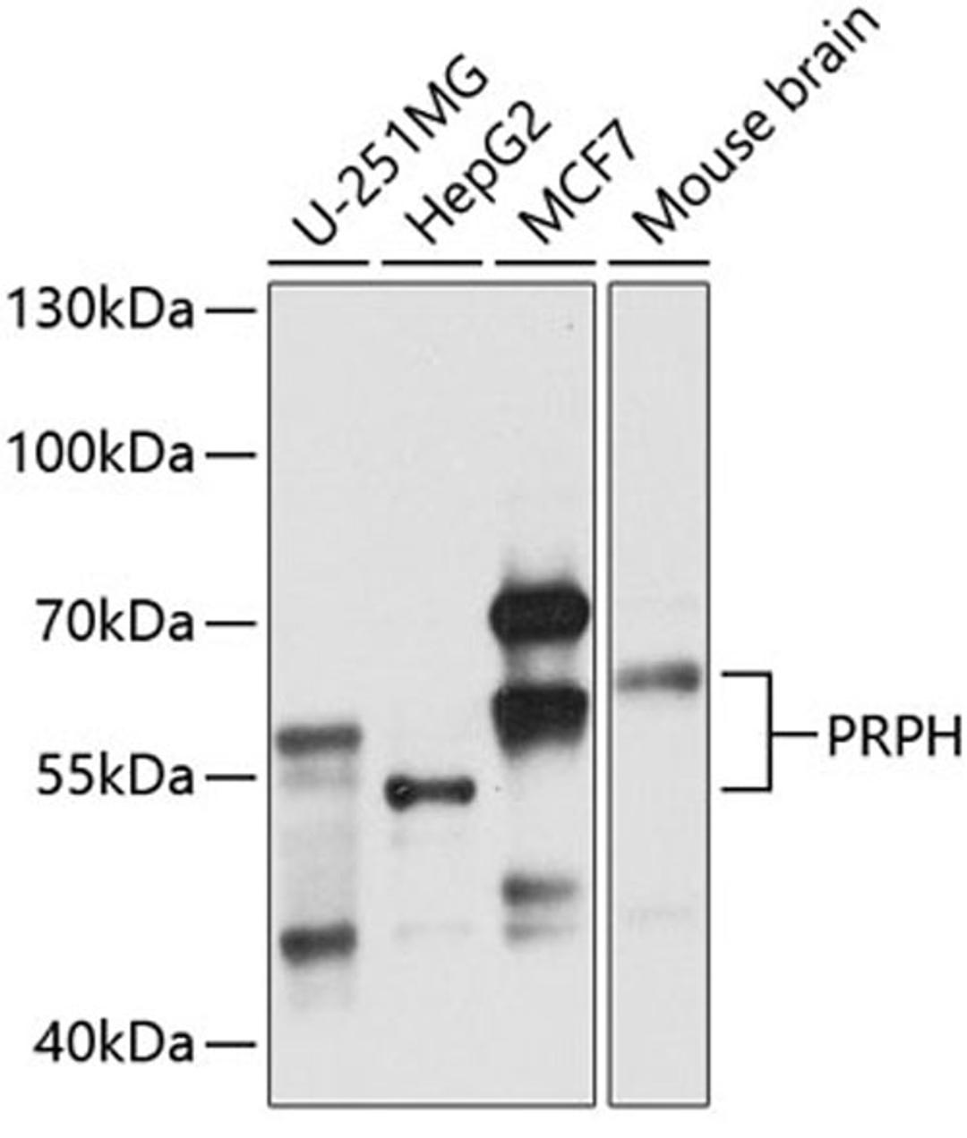 Western blot - PRPH antibody (A4048)