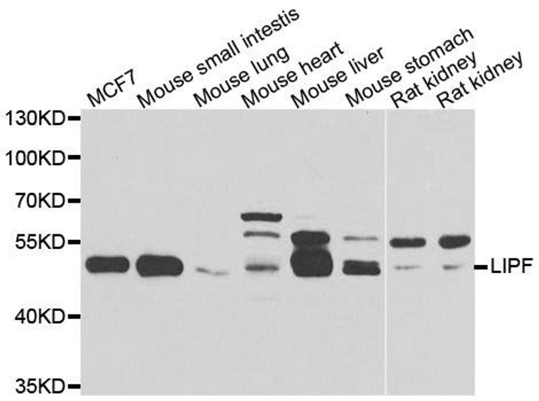 Western blot analysis of extracts of various cell lines using LIPF antibody