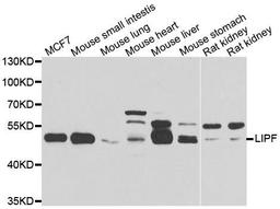 Western blot analysis of extracts of various cell lines using LIPF antibody