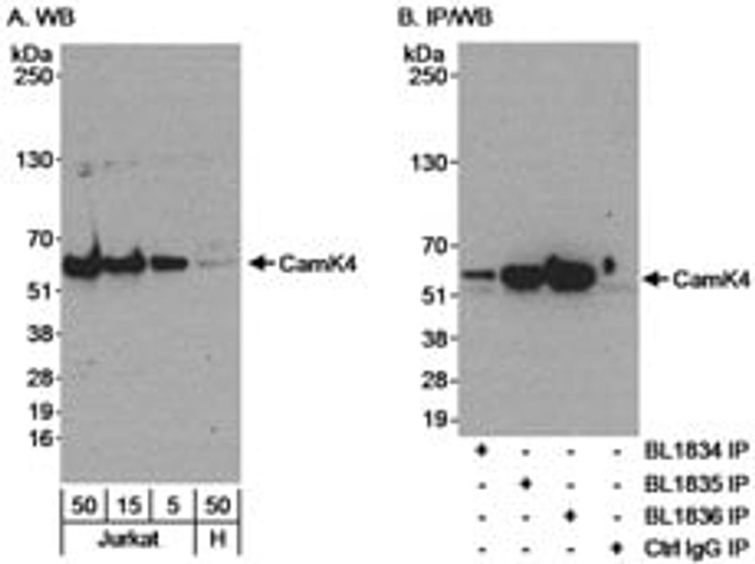 Detection of human CamK4 by western blot and immunoprecipitation.