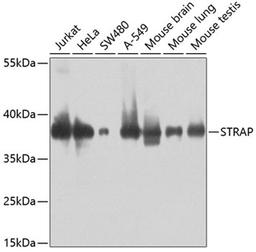 Western blot - STRAP antibody (A5964)