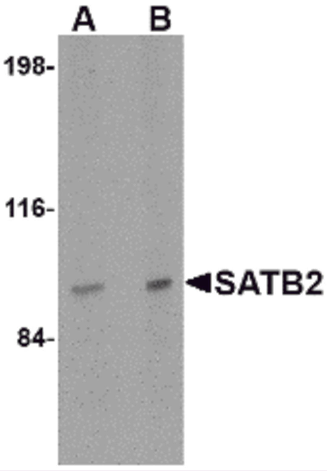 Western blot analysis of SATB2 in mouse brain tissue lysate with SATB2 antibody at (A) 2 and (B) 4 &#956;g/mL.