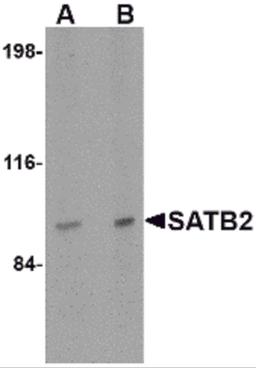 Western blot analysis of SATB2 in mouse brain tissue lysate with SATB2 antibody at (A) 2 and (B) 4 μg/mL.