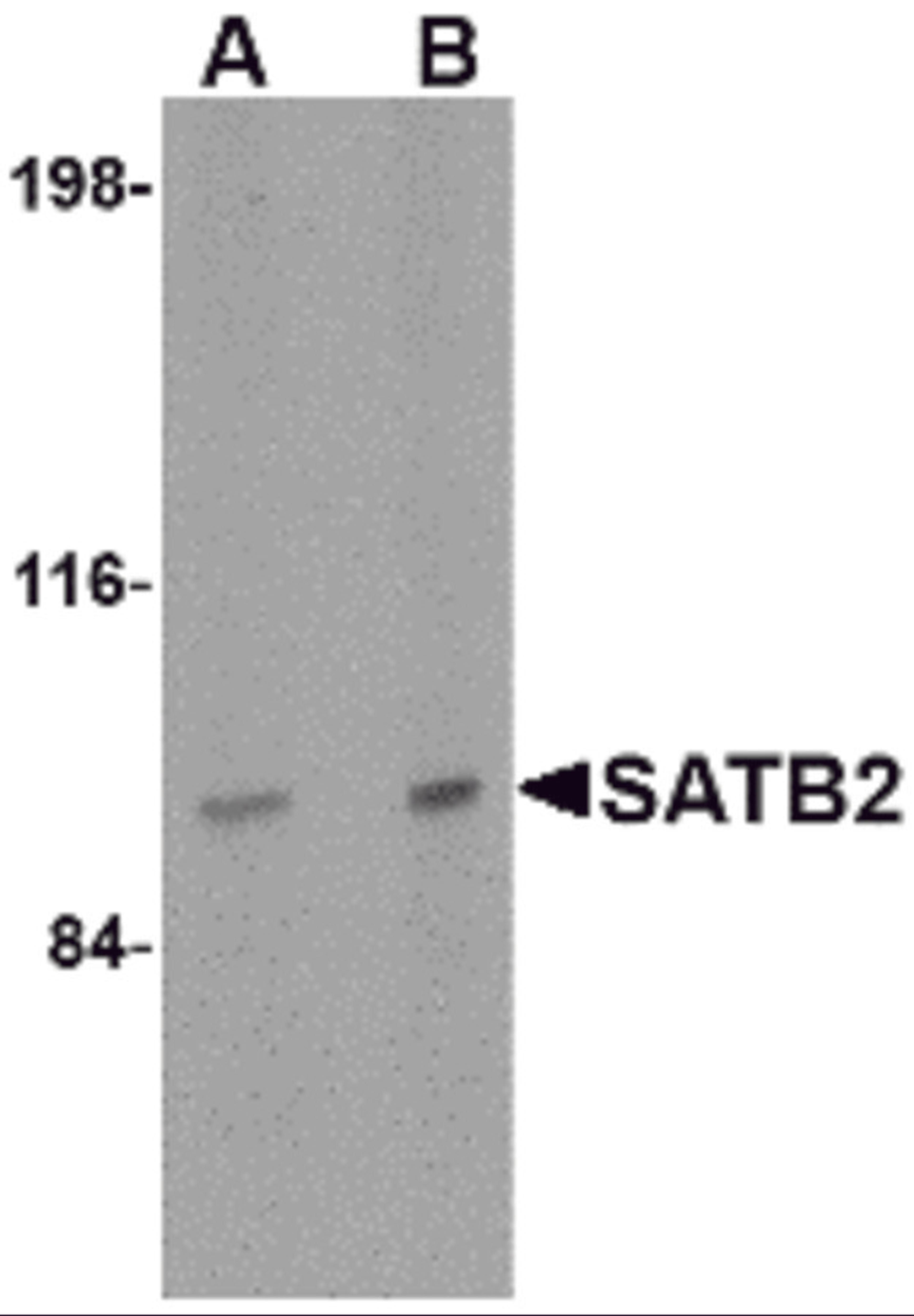 Western blot analysis of SATB2 in mouse brain tissue lysate with SATB2 antibody at (A) 2 and (B) 4 μg/mL.