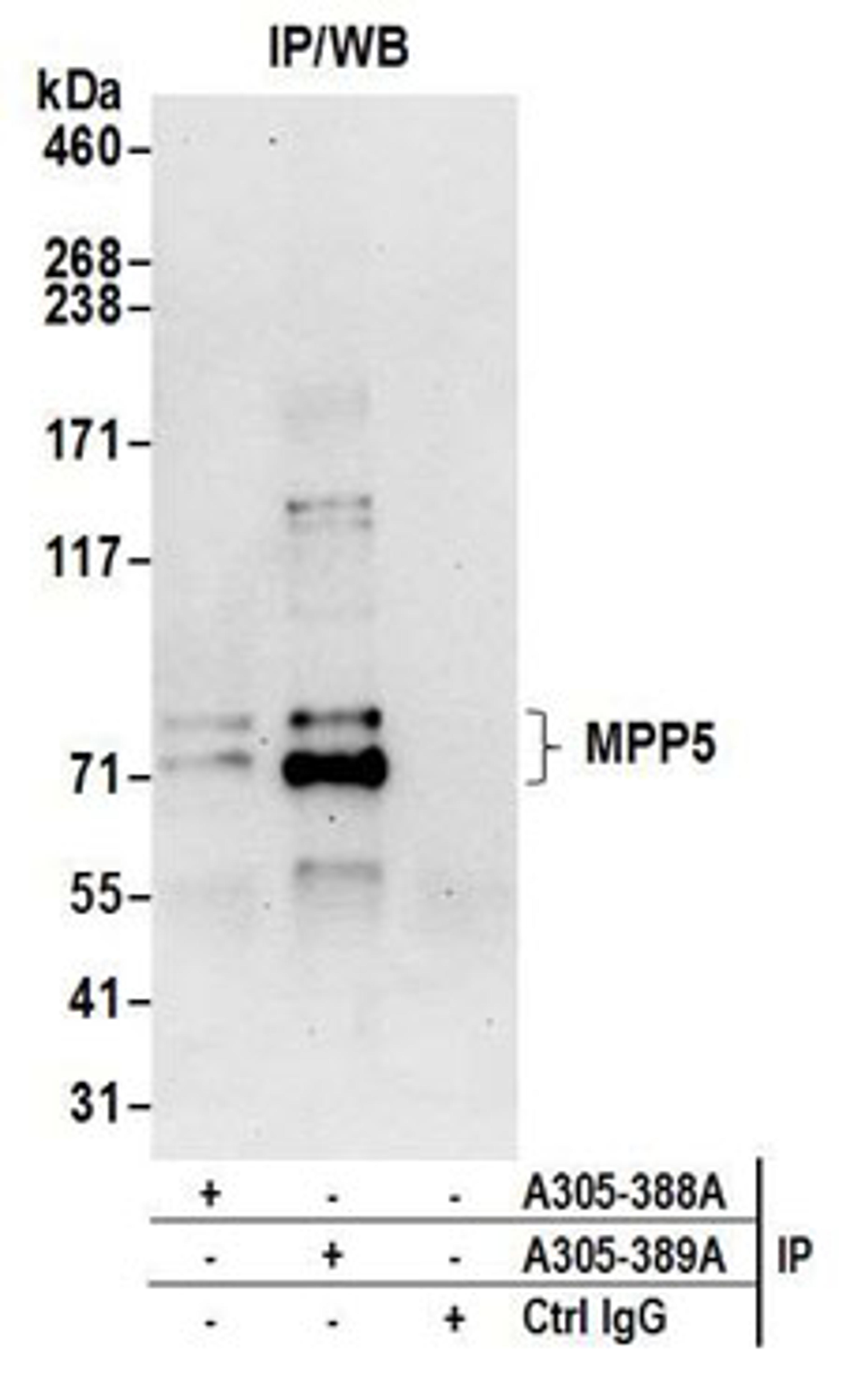 Detection of human MPP5 by western blot of immunoprecipitates.