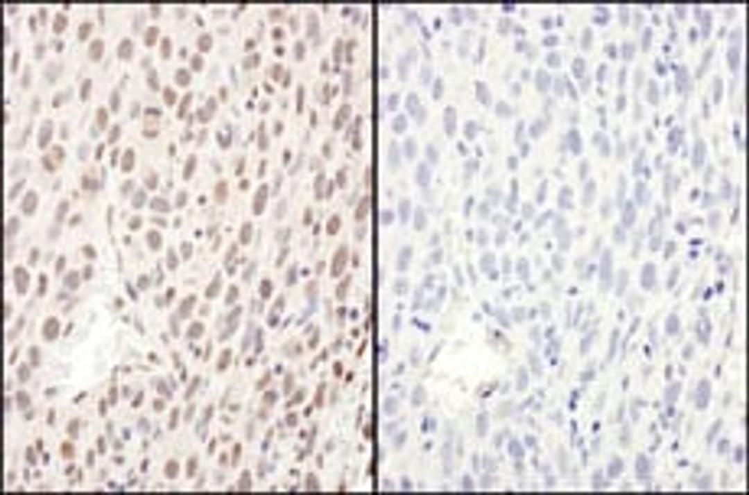 Detection of mouse Phospho RelA (S468) by immunohistochemistry.