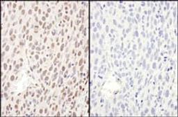 Detection of mouse Phospho RelA (S468) by immunohistochemistry.